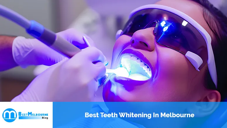 Best Teeth Whitening In Melbourne